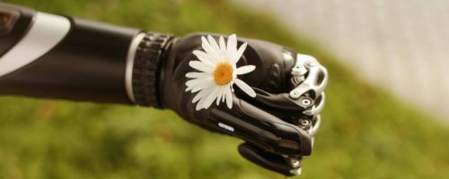 Prosthetics: The past, the present and the future